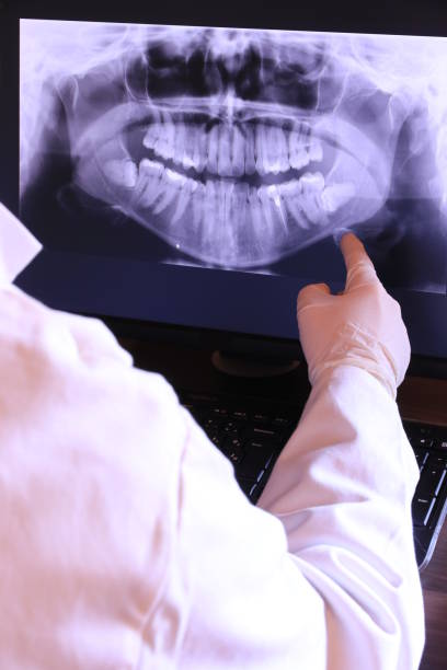Best Dentist for Tooth Abscess  in Lake Of The Woods, IL